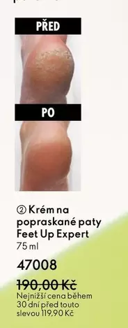 Up - Krém na popraskané paty Feet  Expert
