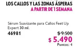 Up - Los Callos Y Las Zonas Asperas A Partir De 1 Semana