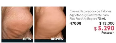 Up - Crema Reparadora De Talones Agerietasdos Y Suavizante Para Pies Feet Expert