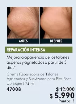 Up - Crema Reparadora De Talones Agrietados Y Suavizante Para Pies Feet