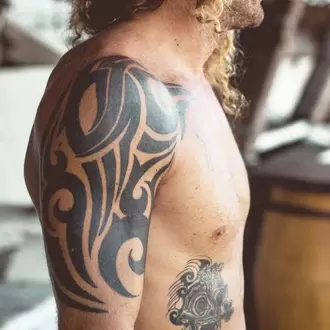 Eliminación de tatuaje brazo 6 sesiones