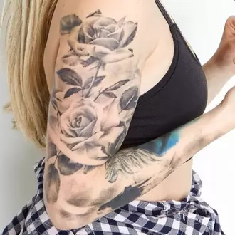 Eliminación de tatuaje brazo 3 sesiones