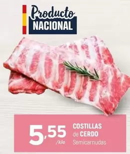 Costillas De Cerdo