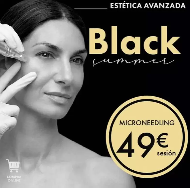Microneedling