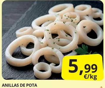 Anillas De Pota