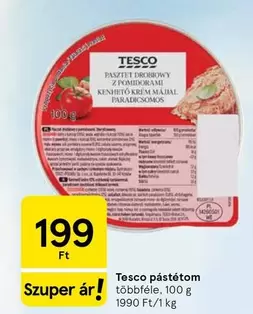 pástétom
