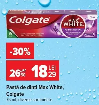 Up - Pastă de dinți Max White