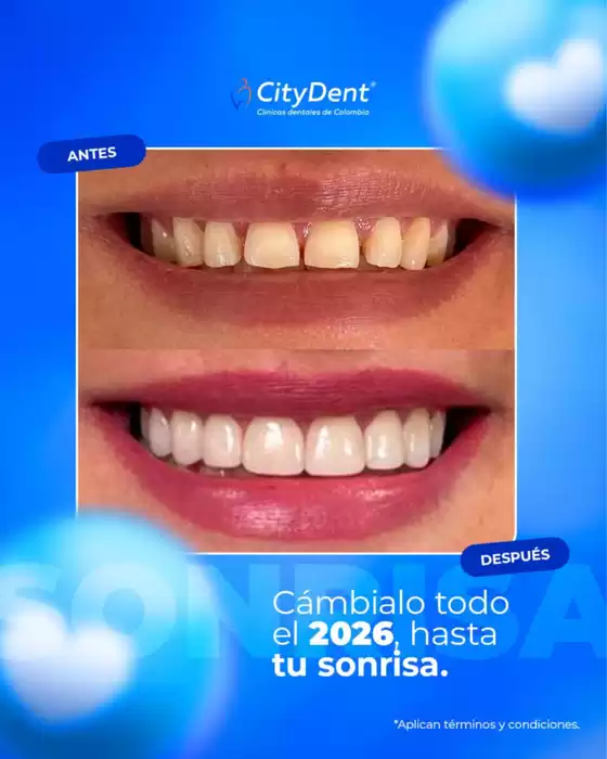 Catálogo Citydent en Aguachica | Cámbialo todo el 2026, hasta tu sonrisa | 2026-04-07T00:00:00.000Z - 2026-12-31T00:00:00.000Z
